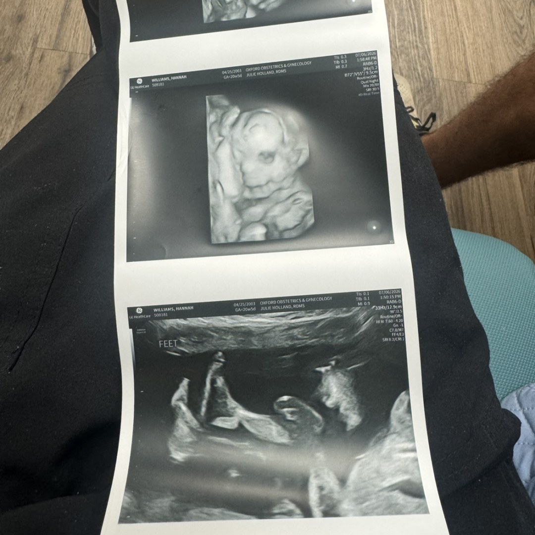 Photo shared by Hannah for their Babylist baby registry.