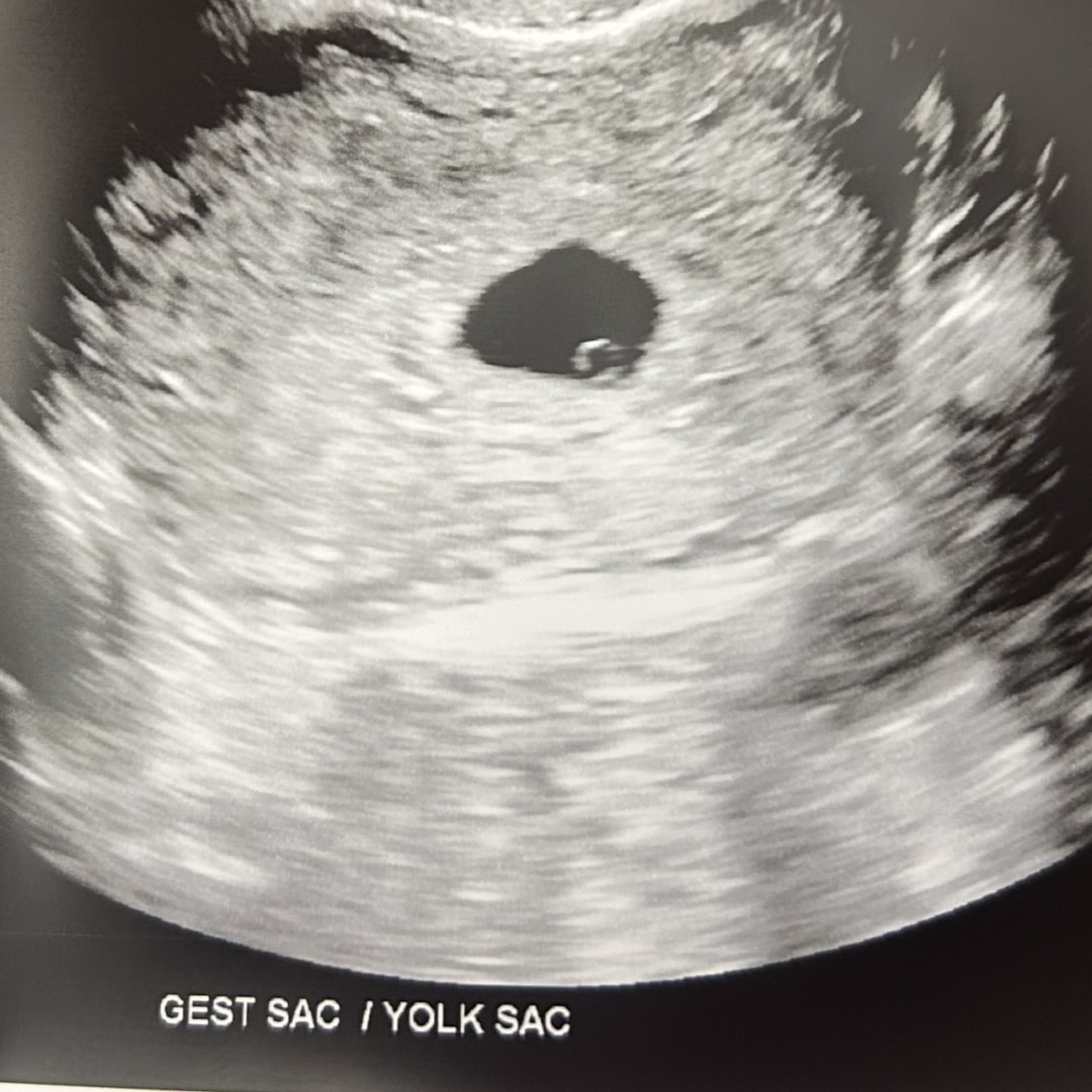 Photo shared by Linda for their Babylist baby registry.