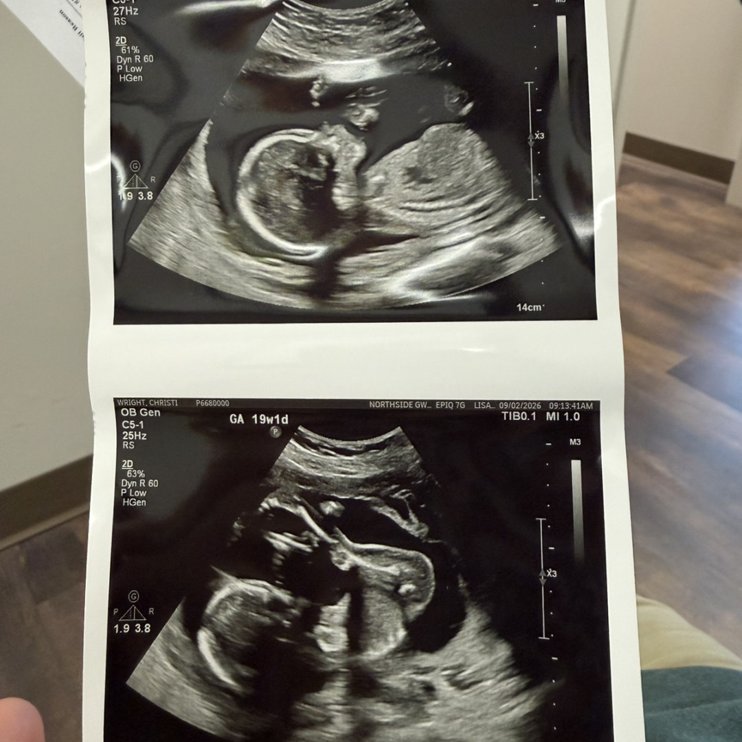 Photo shared by Christi for their Babylist baby registry.