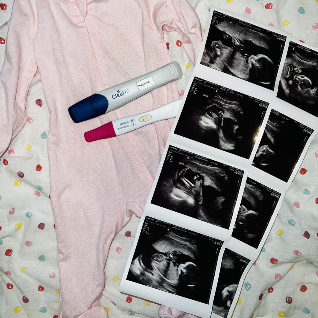 Photo shared by Maddie for their Babylist baby registry.