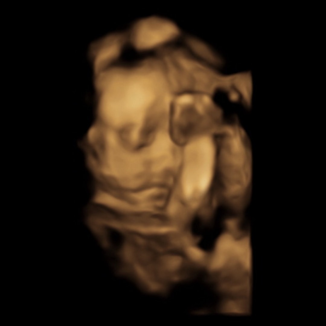 Photo shared by Martie for their Babylist baby registry.