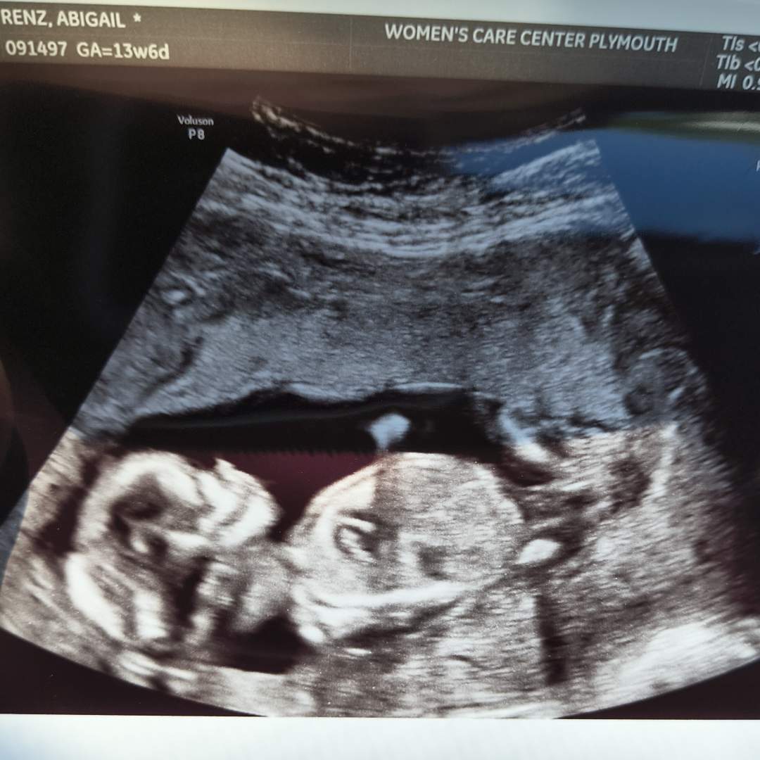 Photo shared by Abby for their Babylist baby registry.