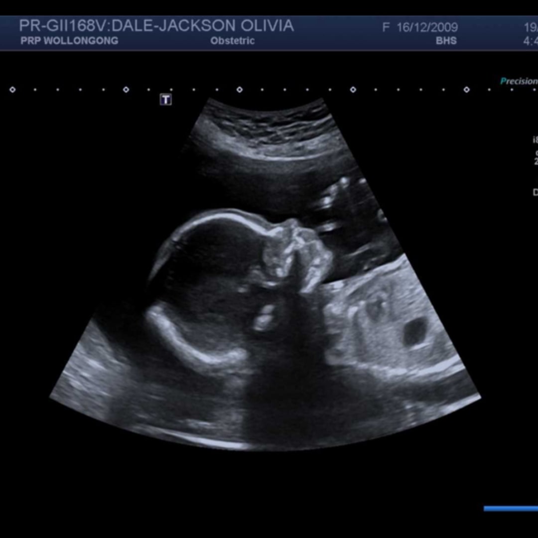 Photo shared by Olivia for their Babylist baby registry.