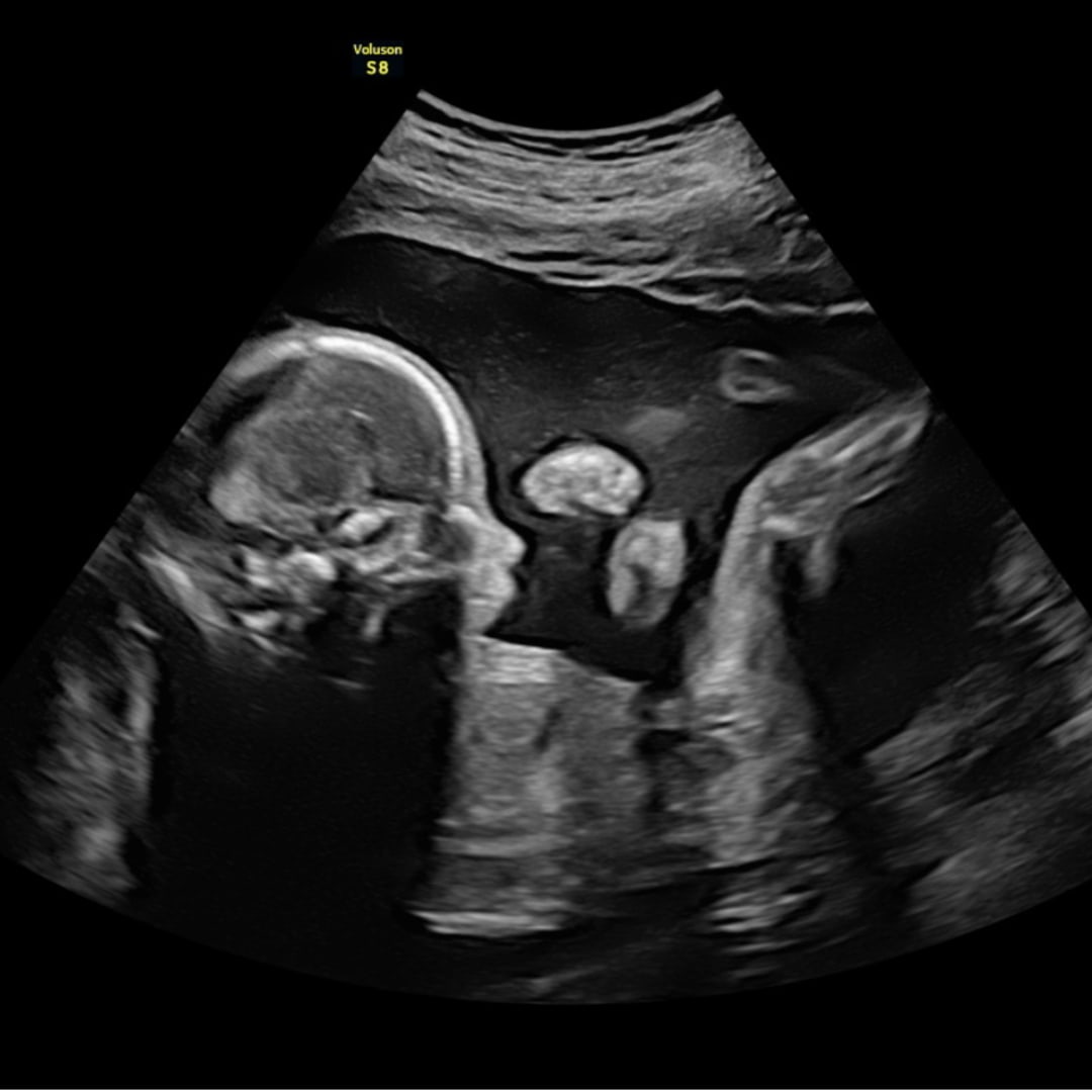 Photo shared by Hanna for their Babylist baby registry.