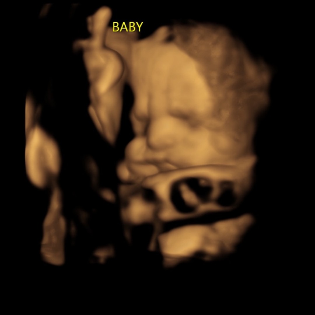 Photo shared by Julie for their Babylist baby registry.