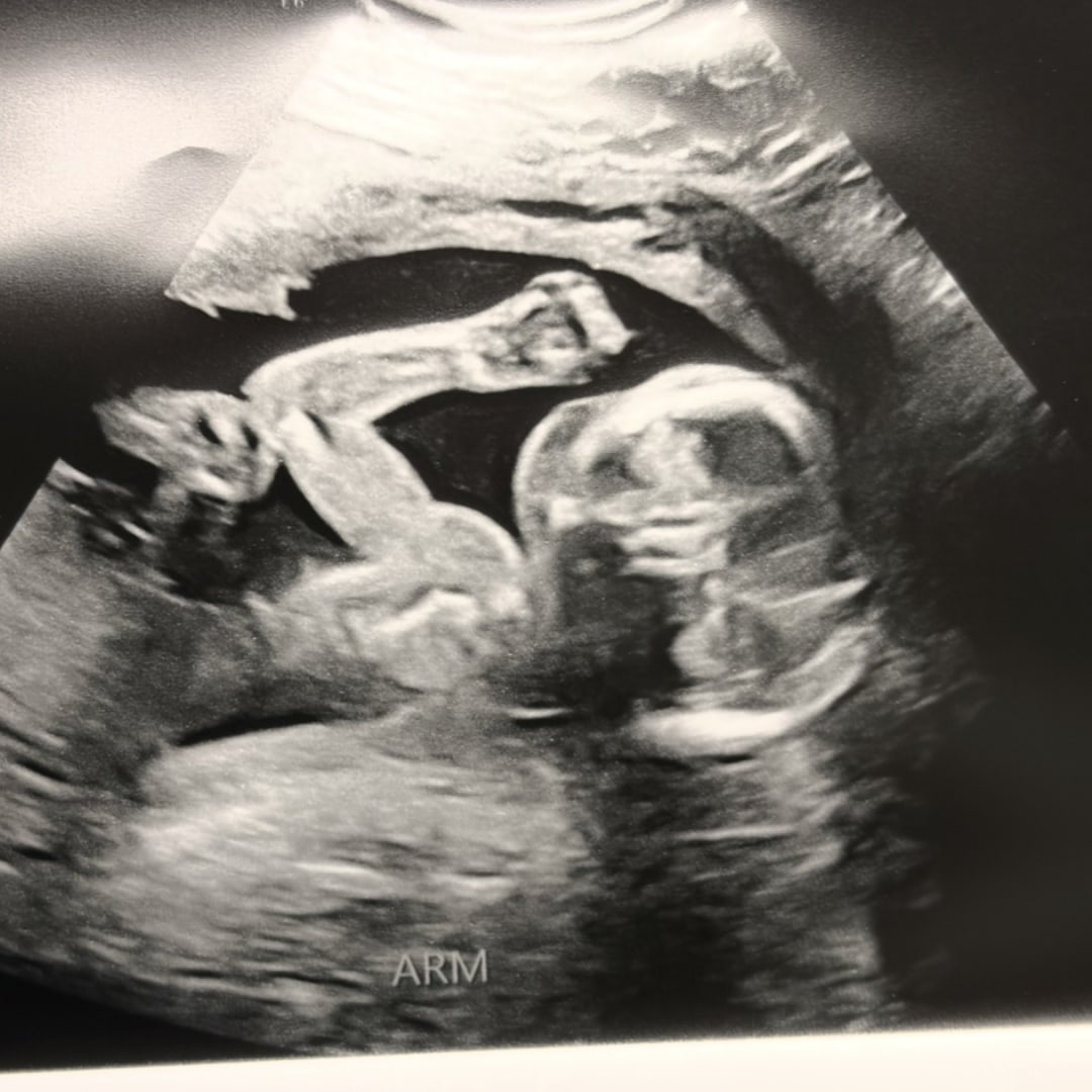 Photo shared by Alicia for their Babylist baby registry.