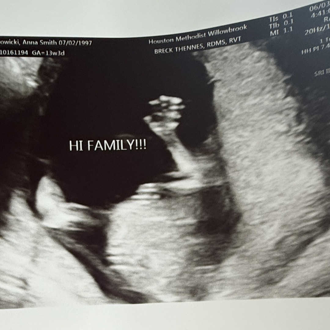 Photo shared by Anna for their Babylist baby registry.