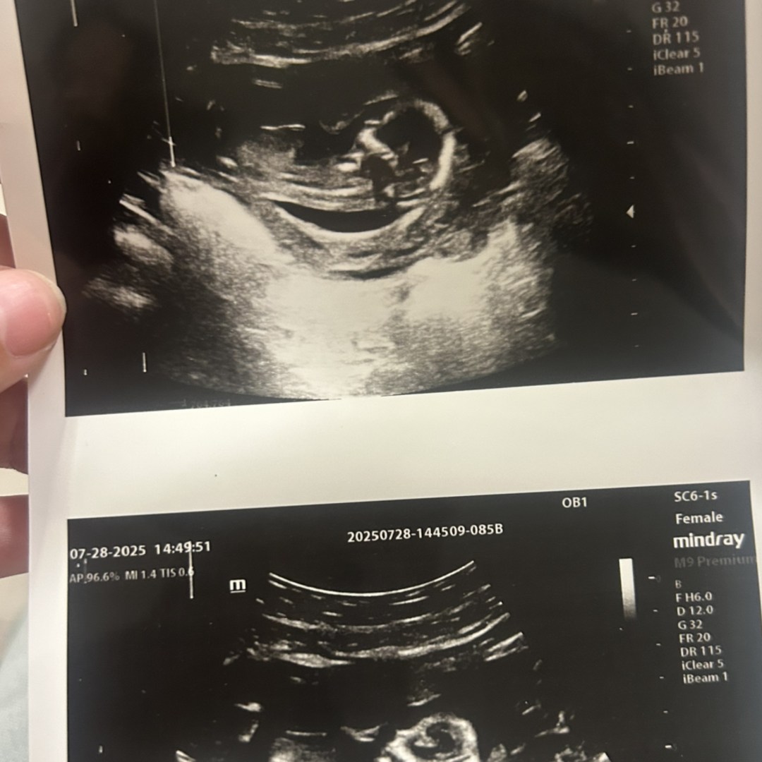 Photo shared by Tiana for their Babylist baby registry.