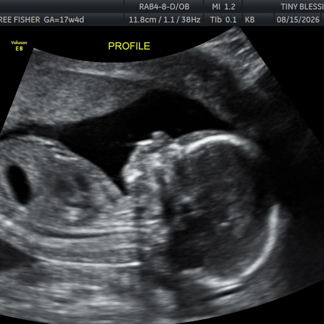 Photo shared by Cambree for their Babylist baby registry.