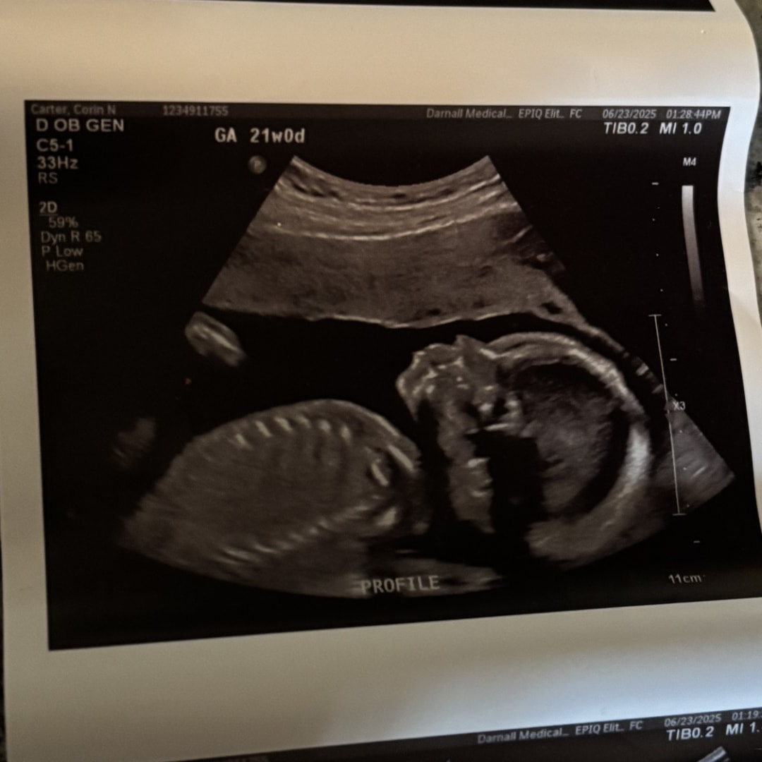 Photo shared by Corin for their Babylist baby registry.