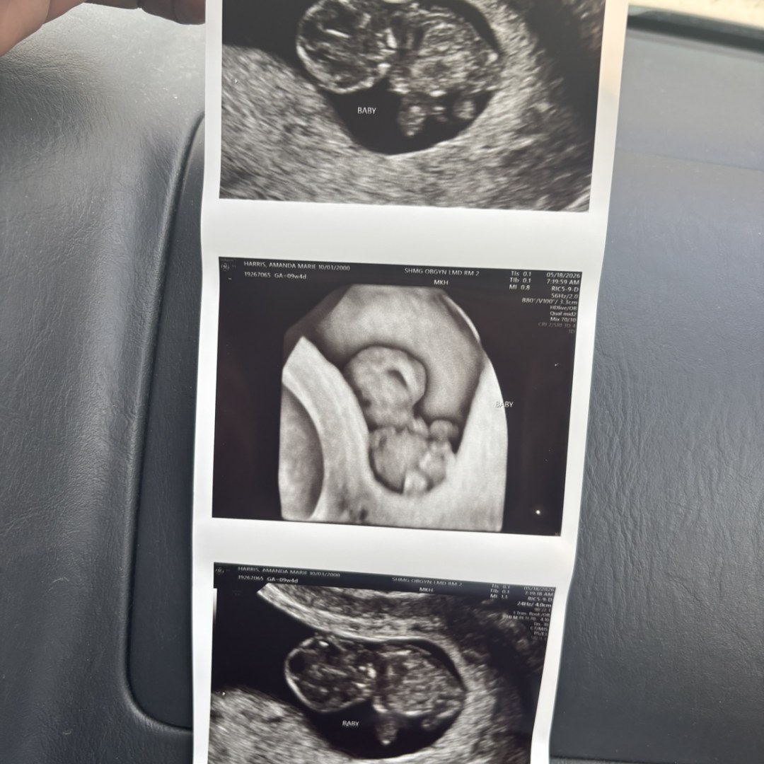 Photo shared by Amanda for their Babylist baby registry.