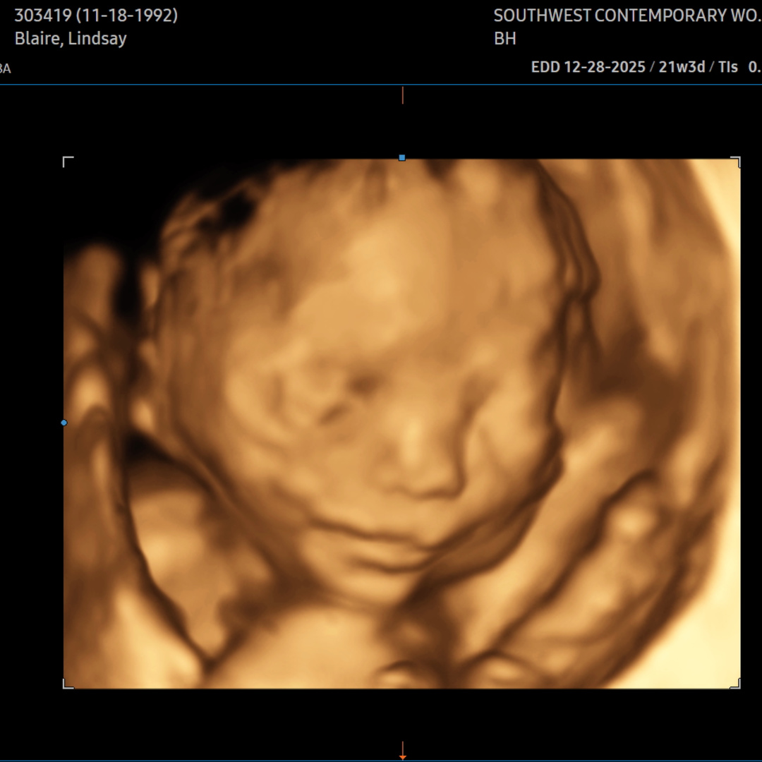 Photo shared by Lindsay for their Babylist baby registry.