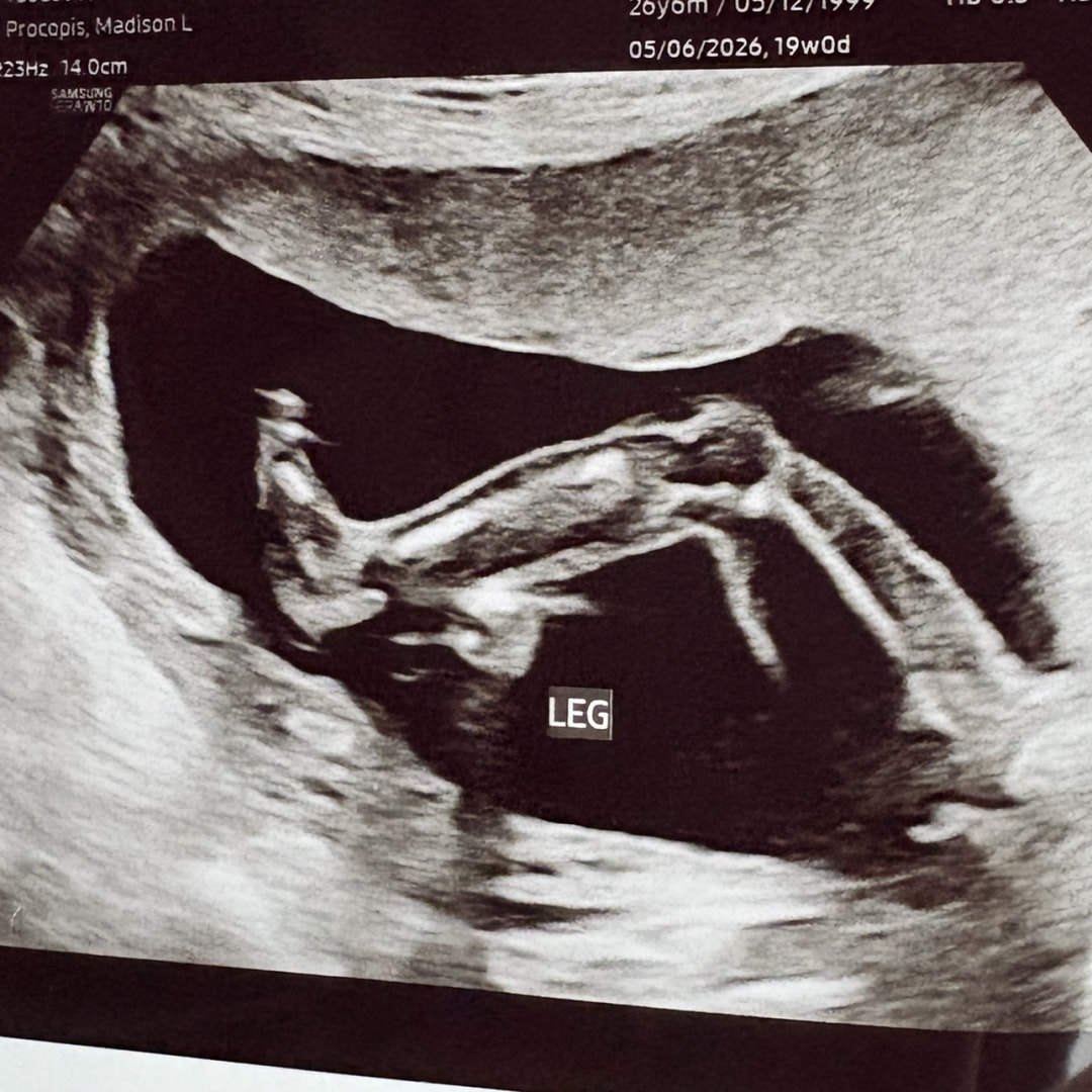 Photo shared by Madison for their Babylist baby registry.