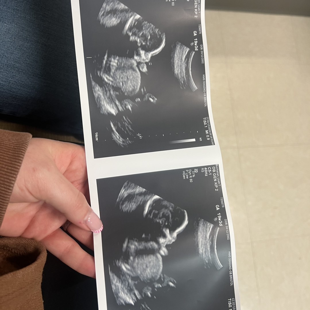 Photo shared by Liyah for their Babylist baby registry.