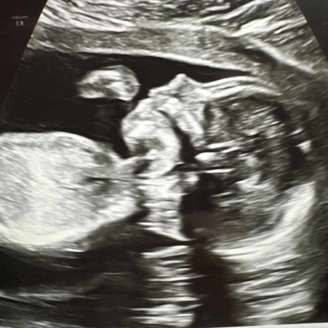 Photo shared by Kayla for their Babylist baby registry.