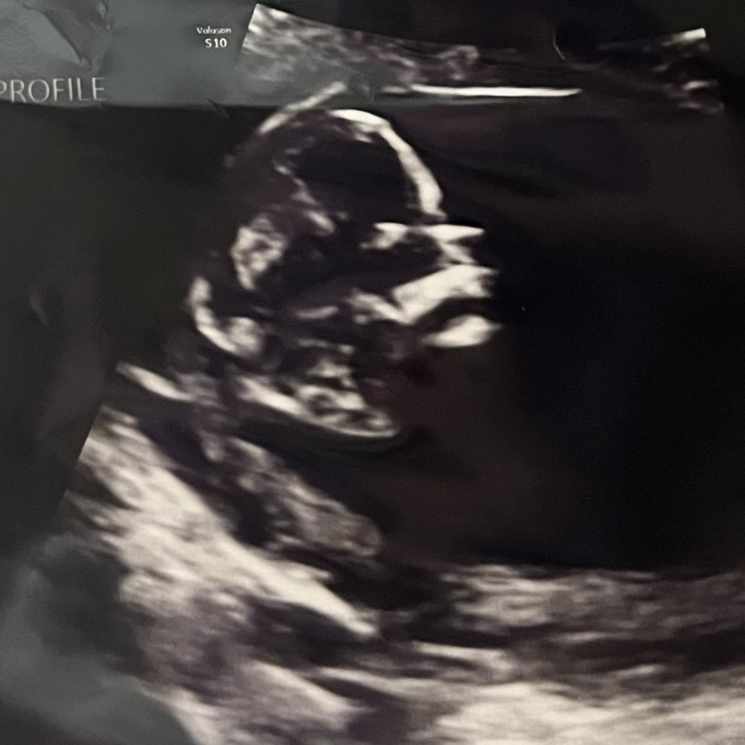 Photo shared by Abby for their Babylist baby registry.