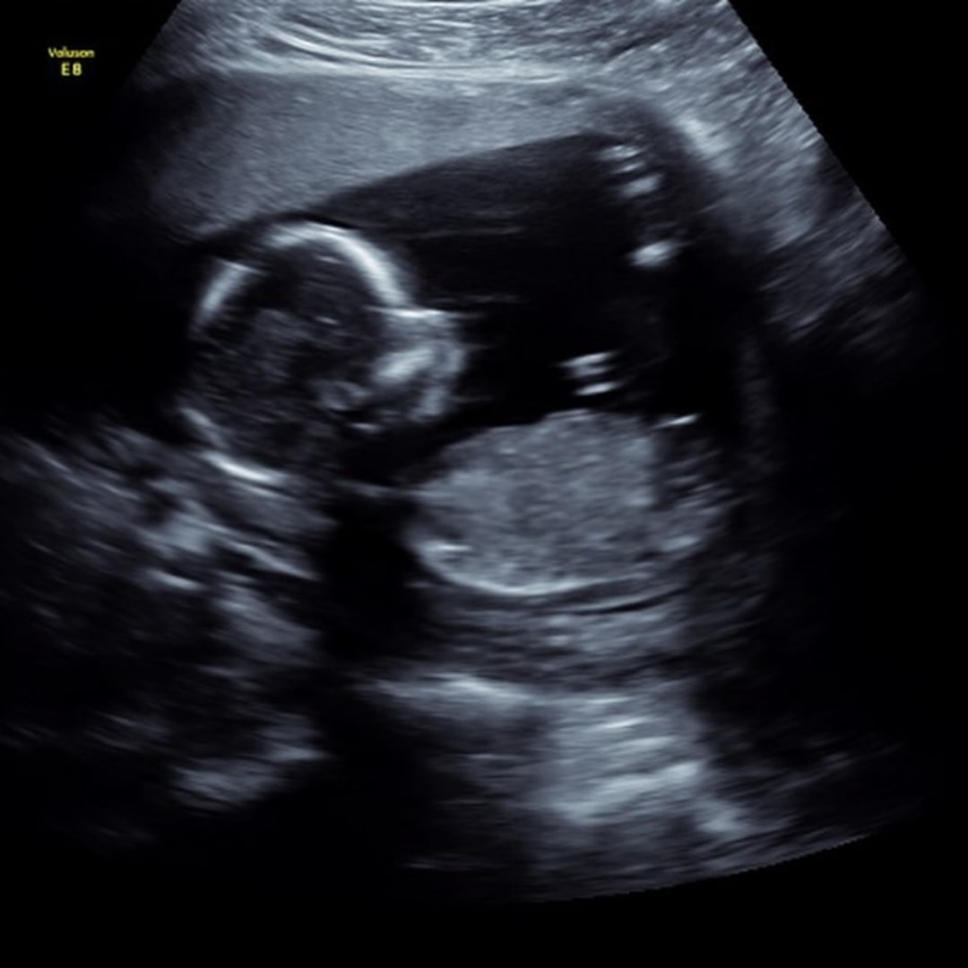 Photo shared by Cassey for their Babylist baby registry.