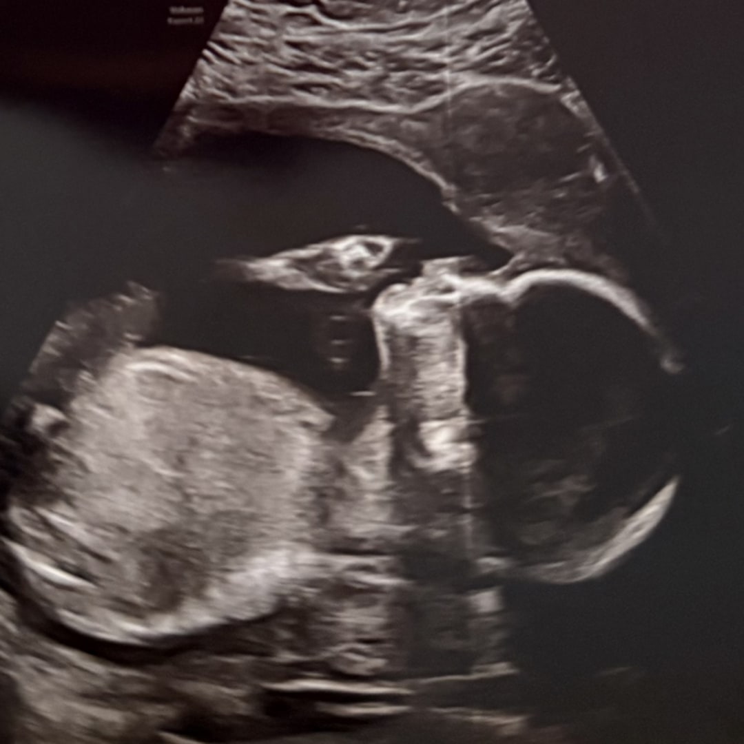 Photo shared by Madison for their Babylist baby registry.