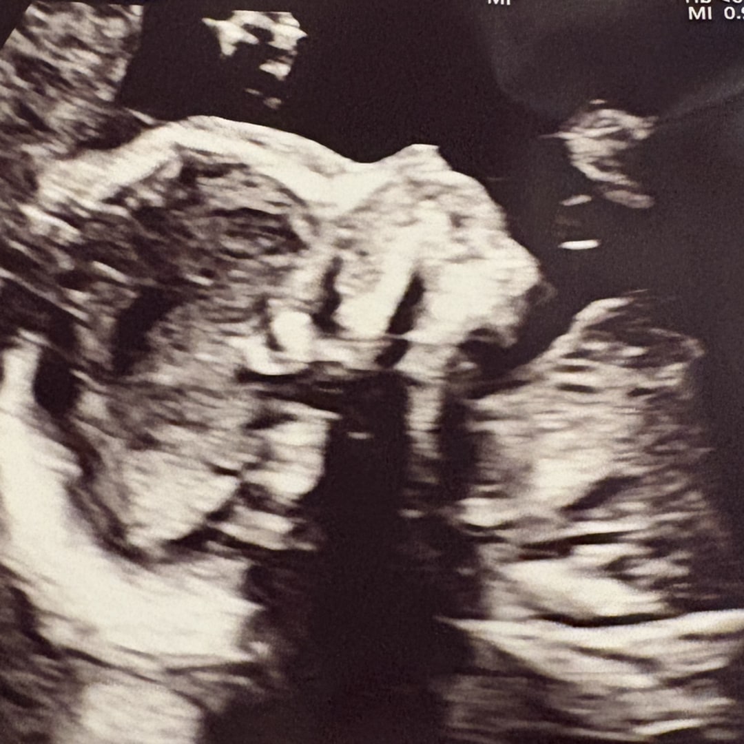 Photo shared by Gabby for their Babylist baby registry.