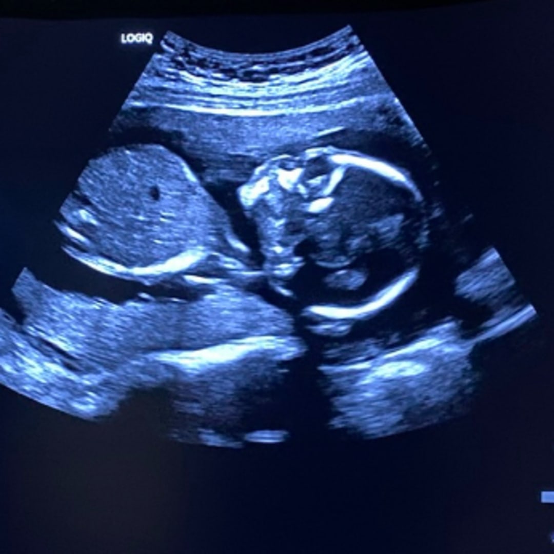 Photo shared by Alexandria for their Babylist baby registry.