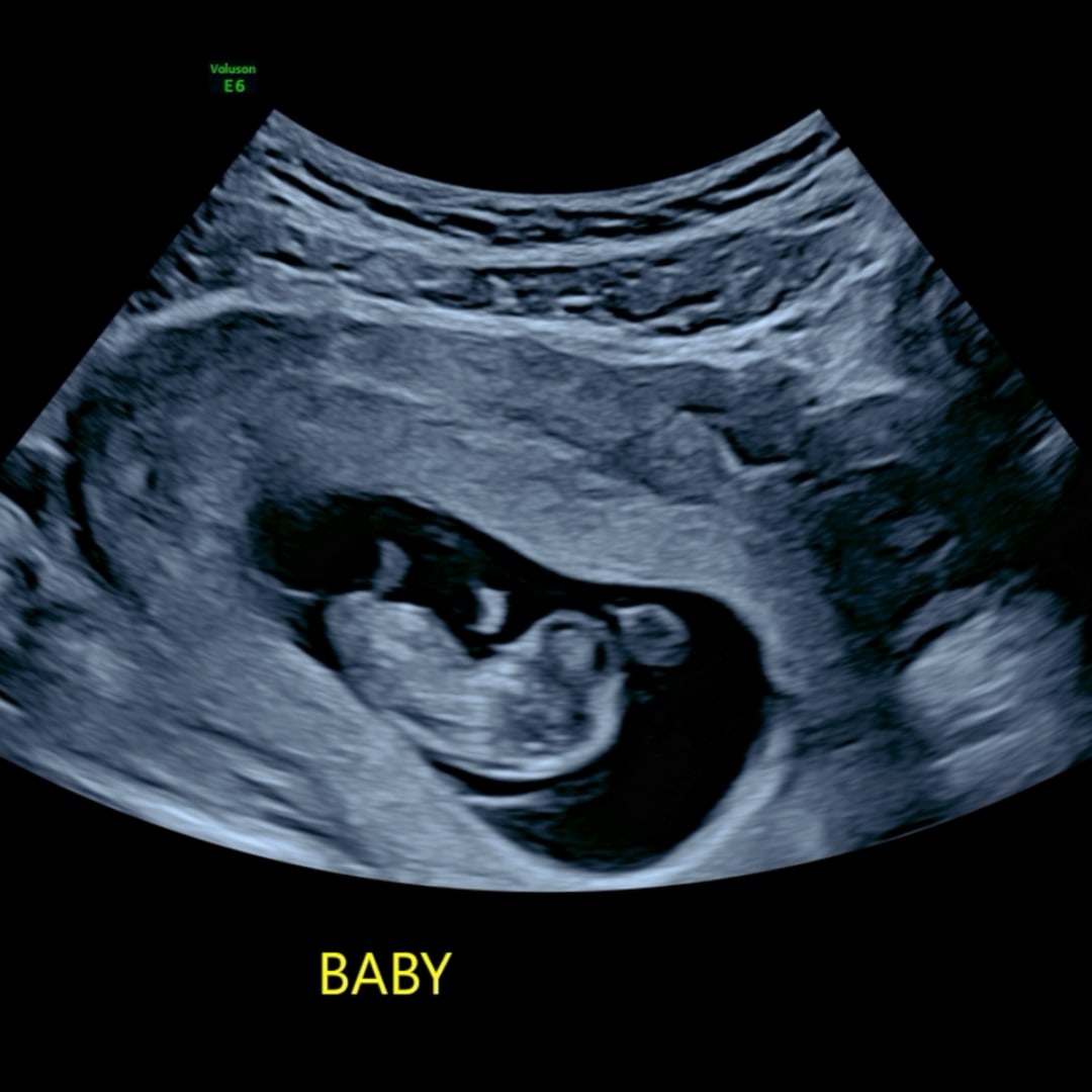 Photo shared by Danyelin for their Babylist baby registry.