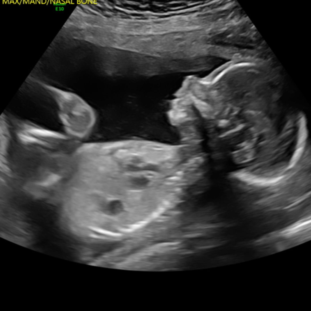 Photo shared by Alex for their Babylist baby registry.