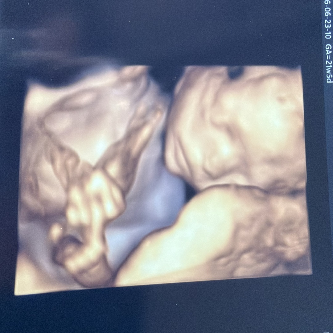 Photo shared by Alani for their Babylist baby registry.
