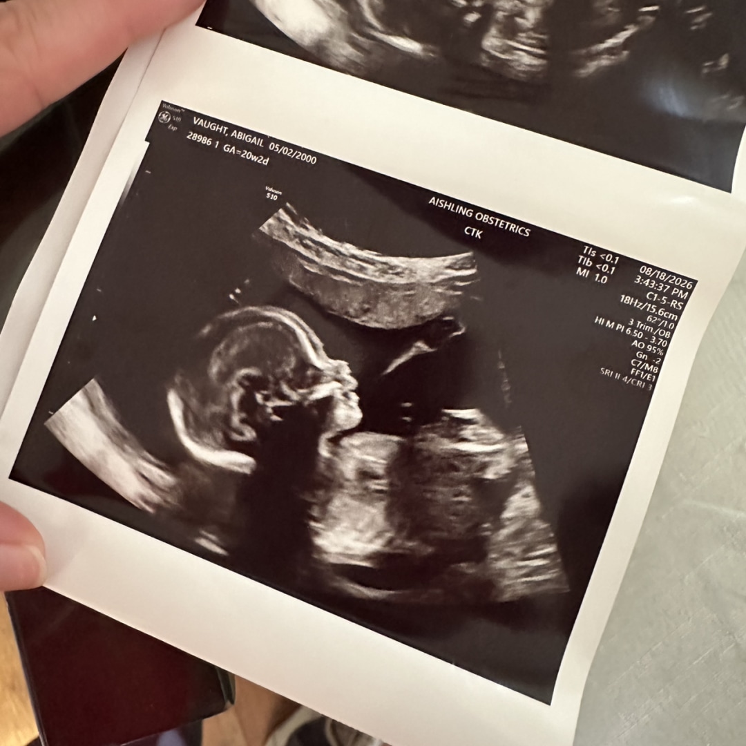 Photo shared by Abigail for their Babylist baby registry.