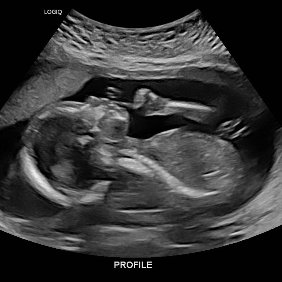 Photo shared by Allison for their Babylist baby registry.