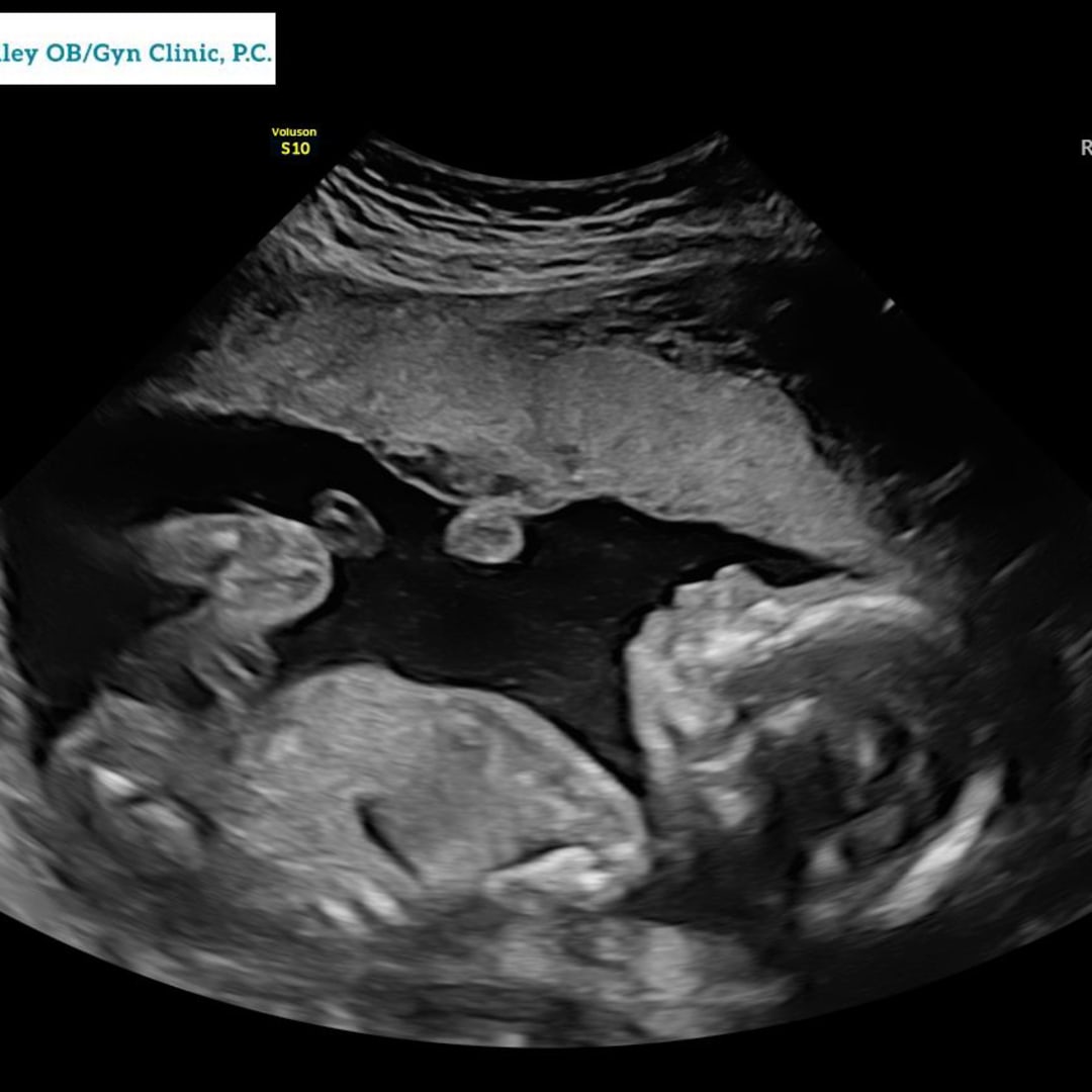 Photo shared by Kennedy for their Babylist baby registry.