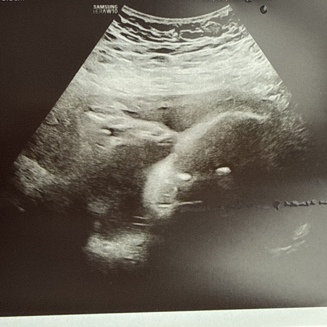 Photo shared by Leilani for their Babylist baby registry.