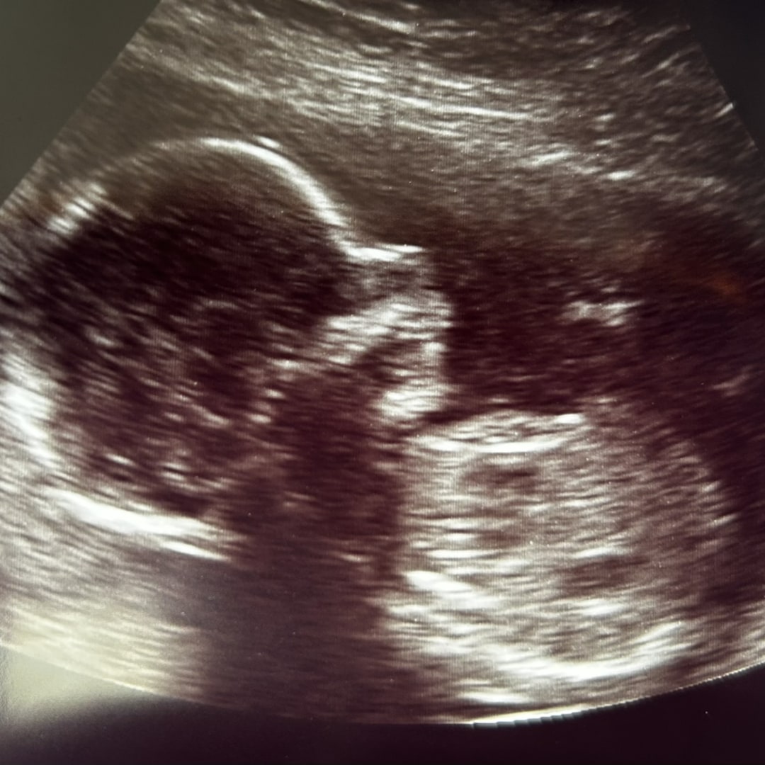 Photo shared by Lauren for their Babylist baby registry.
