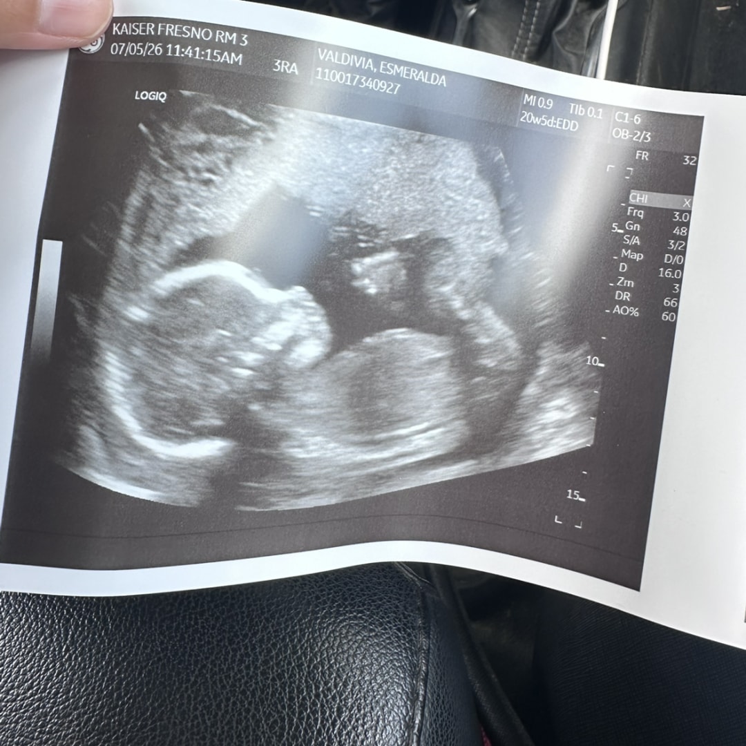Photo shared by Esmeralda for their Babylist baby registry.