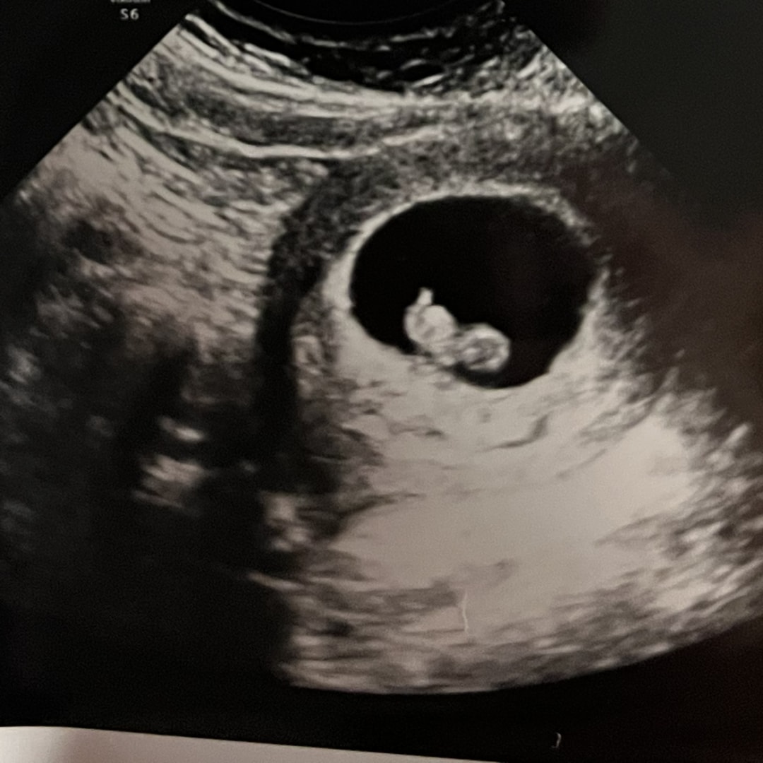 Photo shared by Katelyn for their Babylist baby registry.