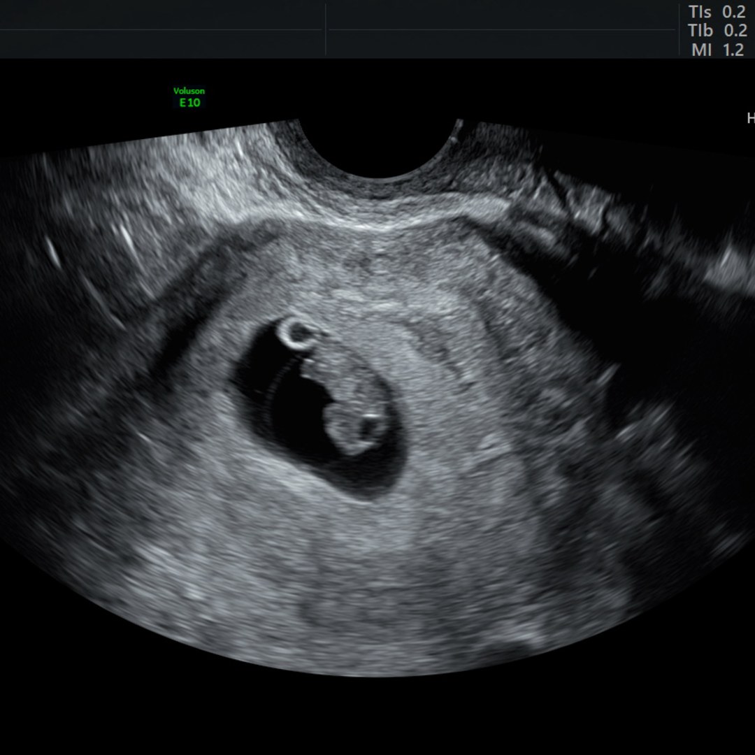 Photo shared by Madison for their Babylist baby registry.