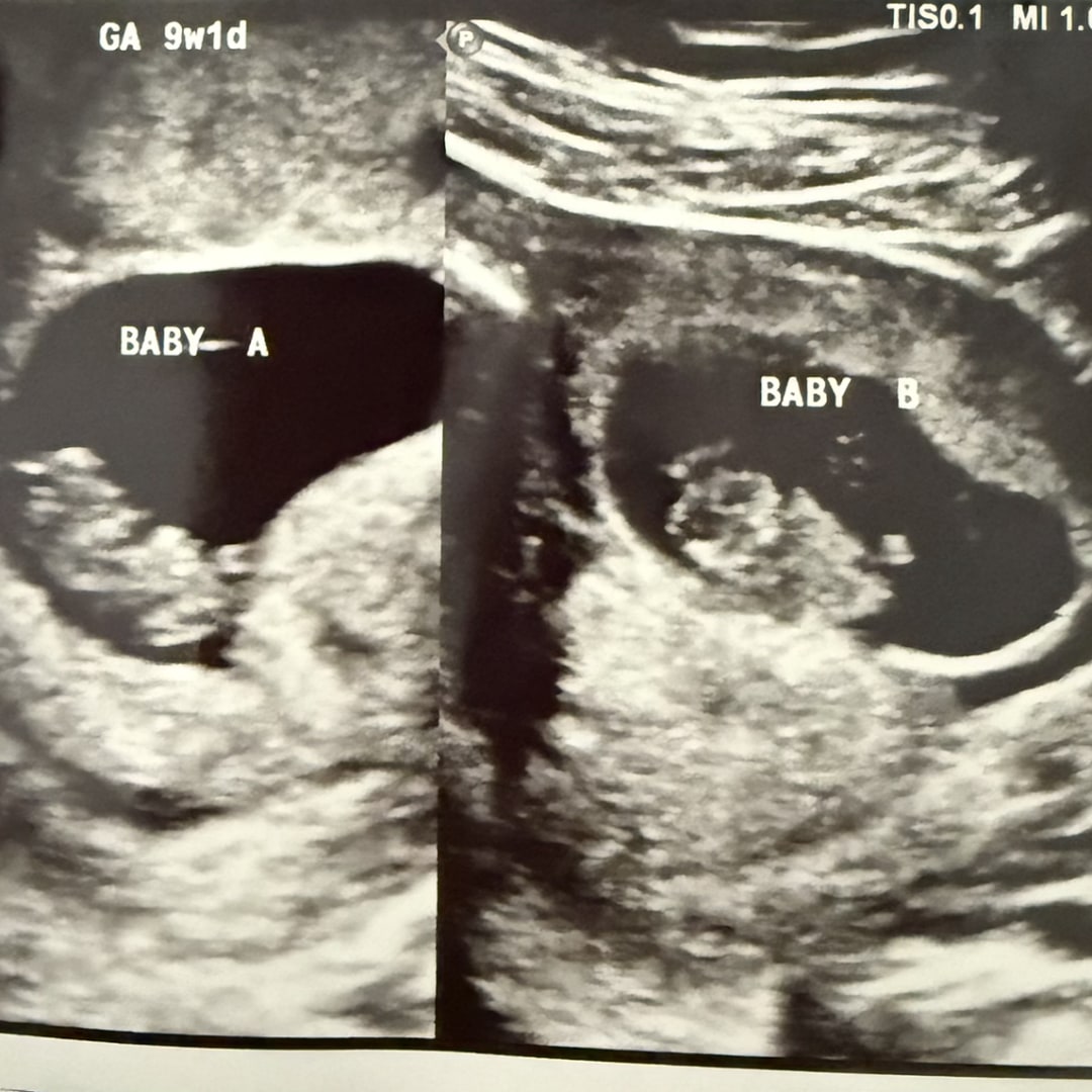 Photo shared by Amy for their Babylist baby registry.