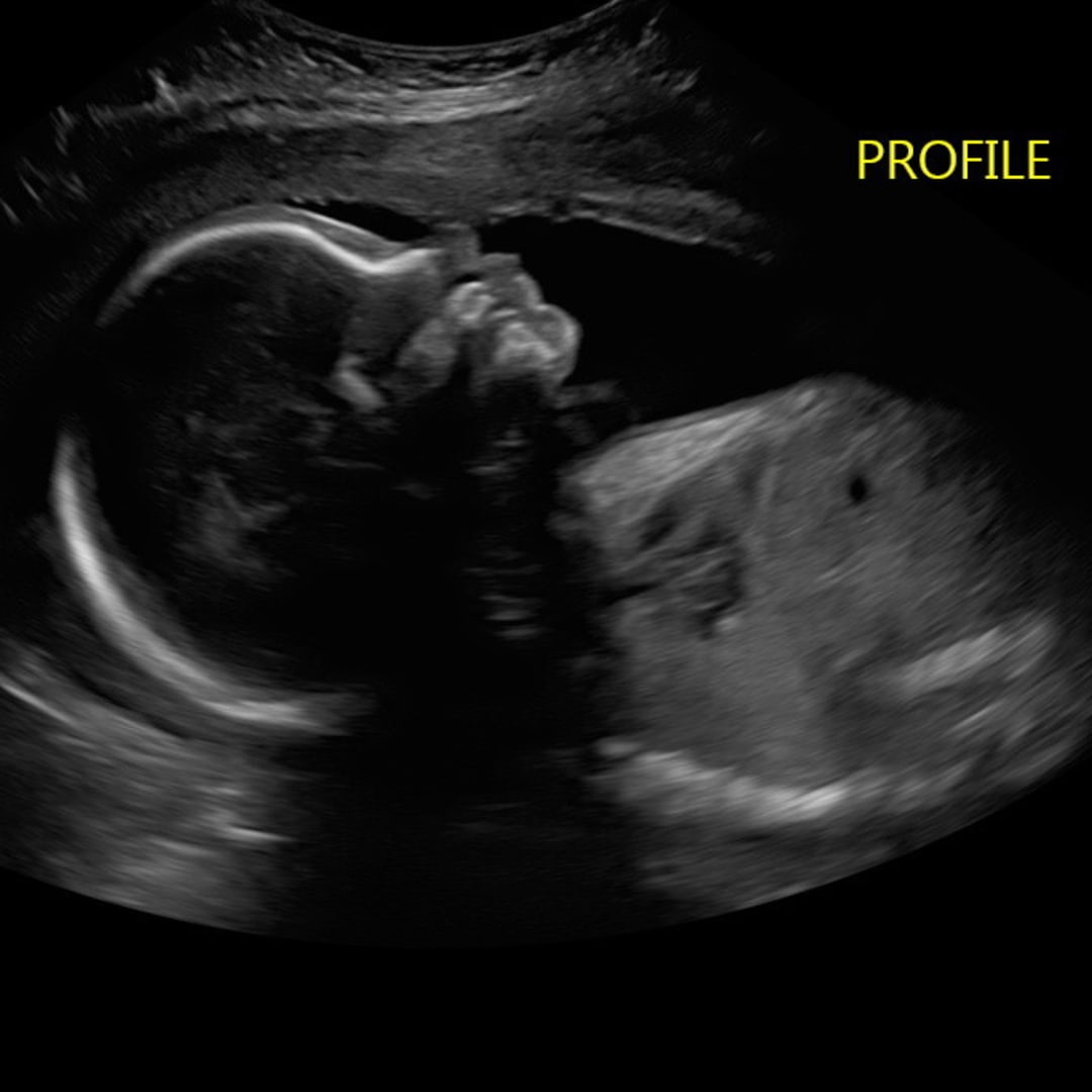 Photo shared by Jenny for their Babylist baby registry.