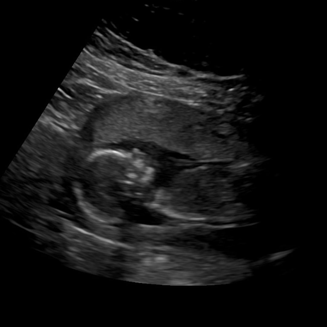 Photo shared by Cassie for their Babylist baby registry.