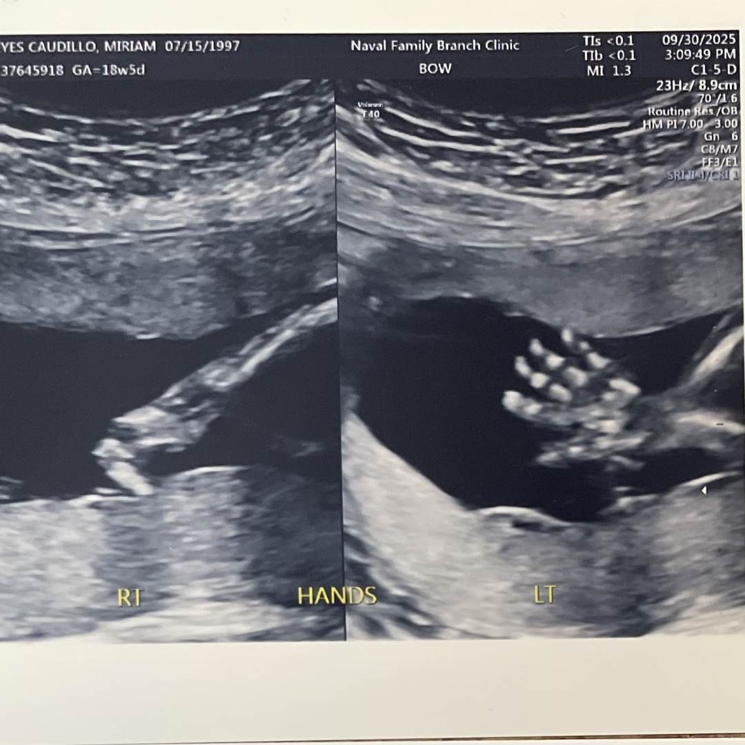 Photo shared by Miriam for their Babylist baby registry.