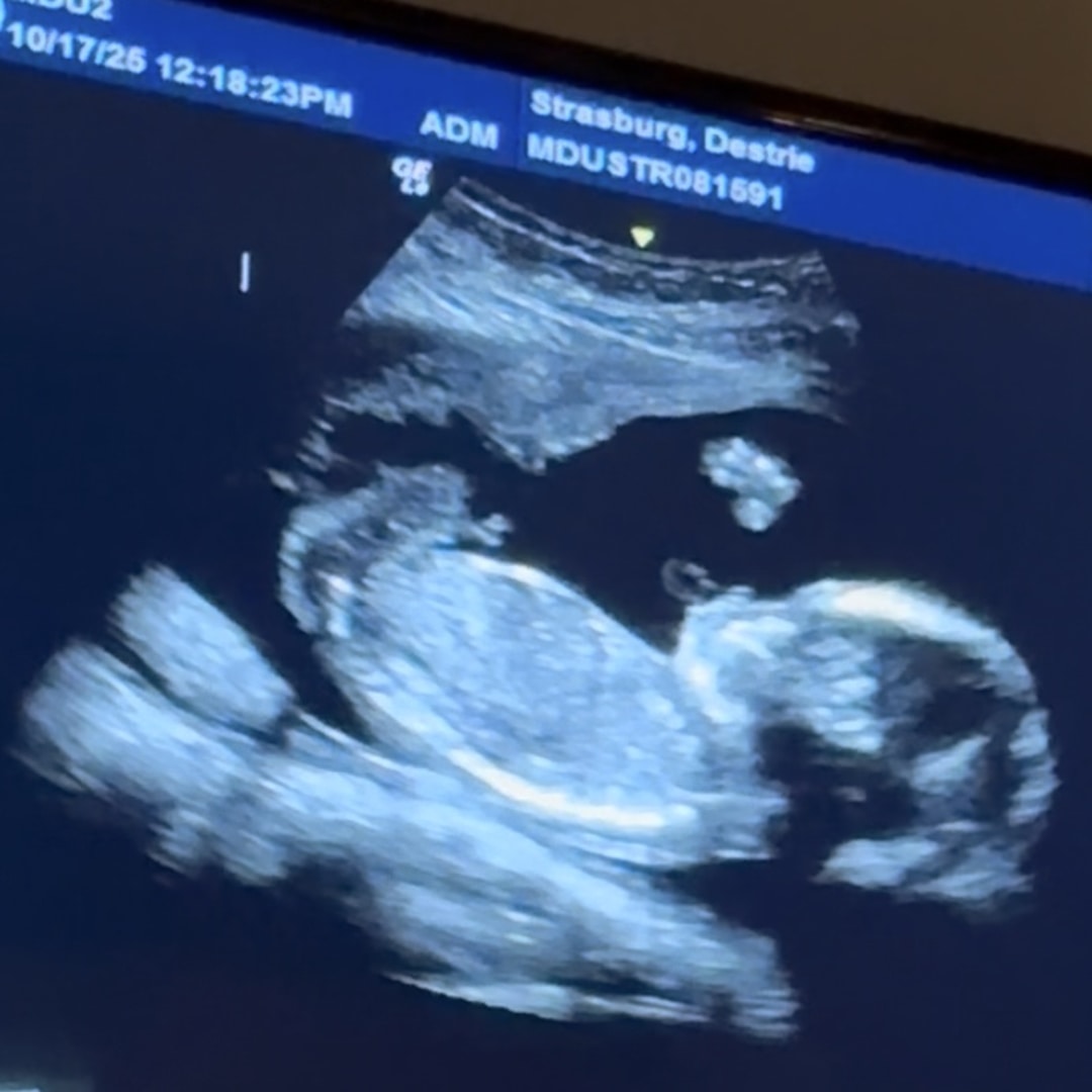 Photo shared by Destrie for their Babylist baby registry.