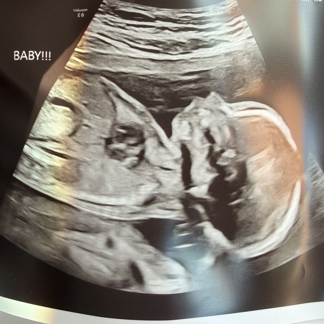 Photo shared by Sabrina for their Babylist baby registry.