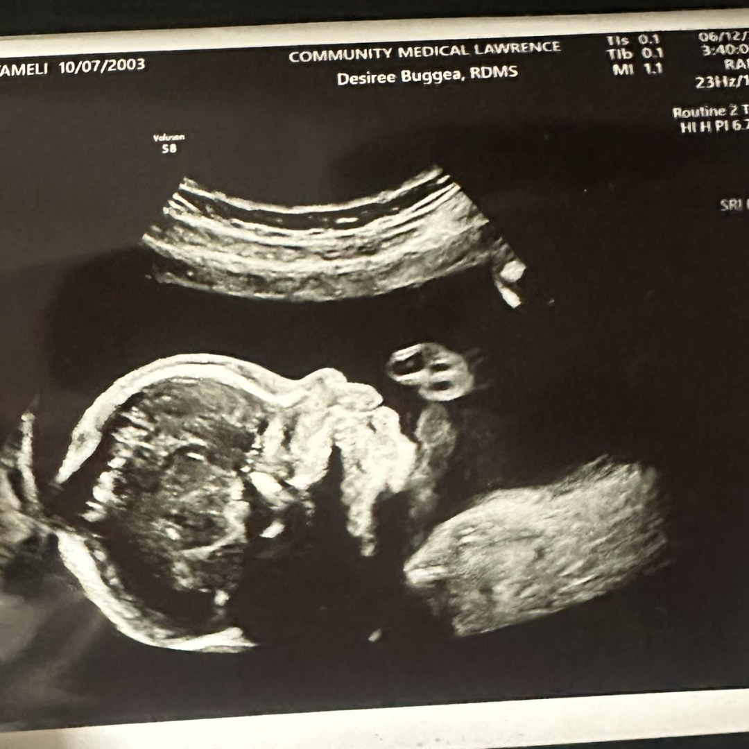 Photo shared by Yameli for their Babylist baby registry.