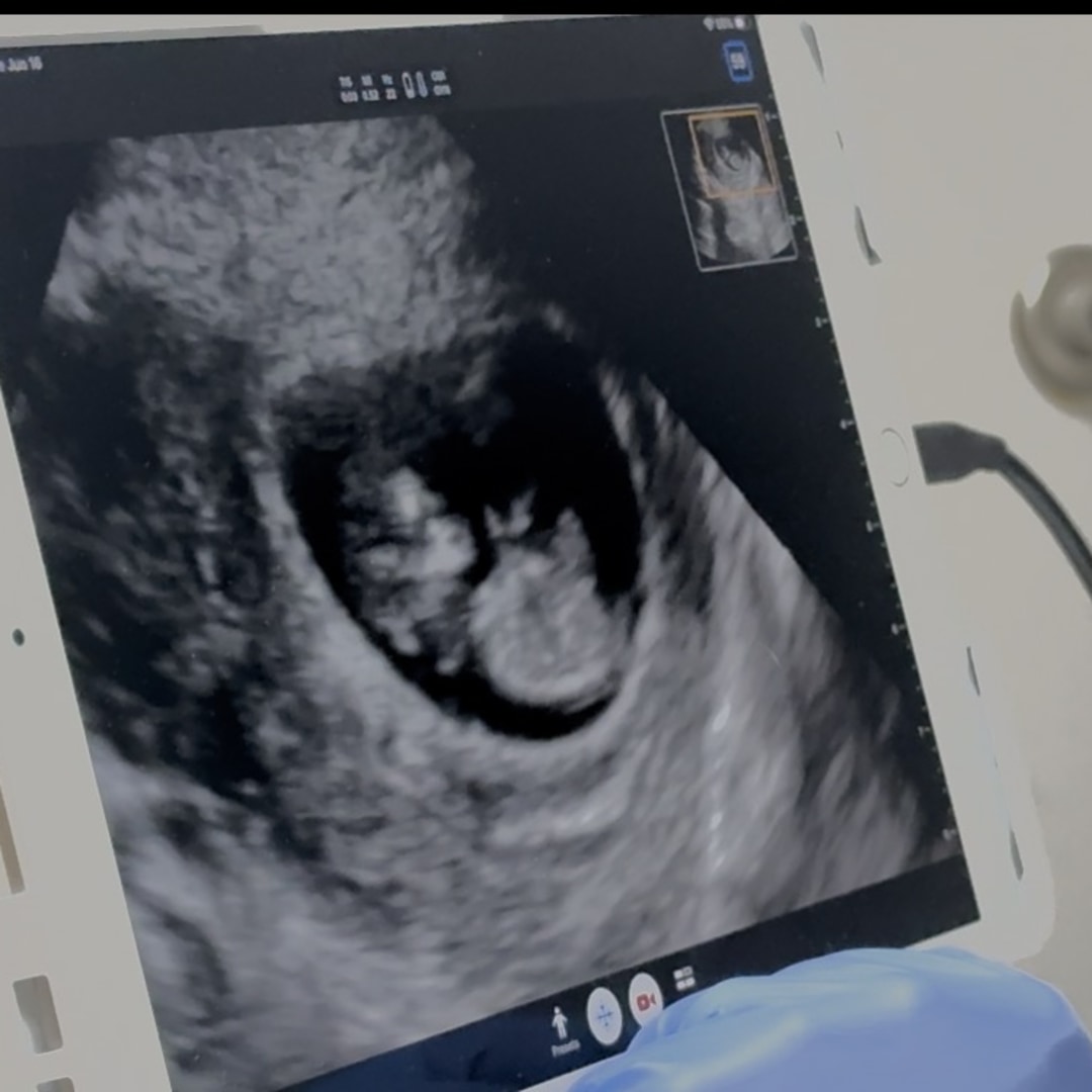 Photo shared by Zoe for their Babylist baby registry.