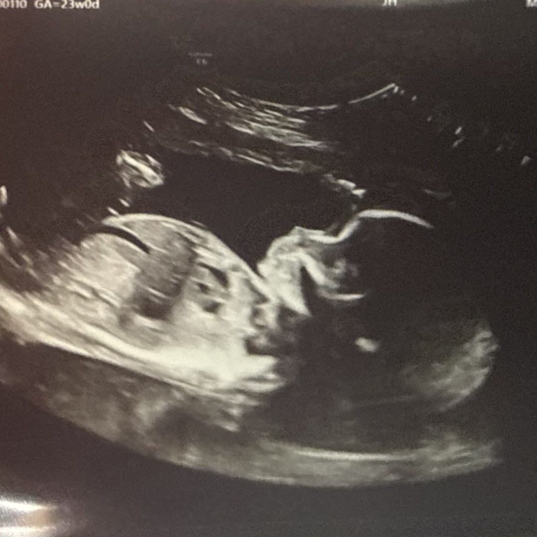 Photo shared by Addison for their Babylist baby registry.