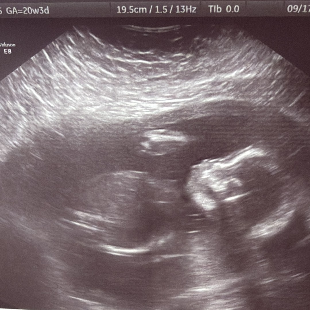 Photo shared by Jennifer for their Babylist baby registry.