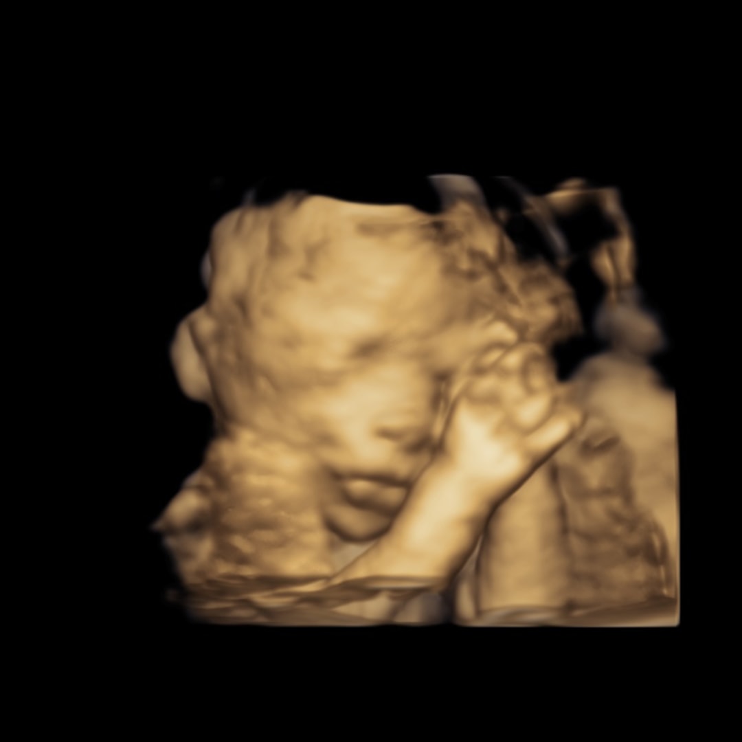 Photo shared by Giovanna for their Babylist baby registry.