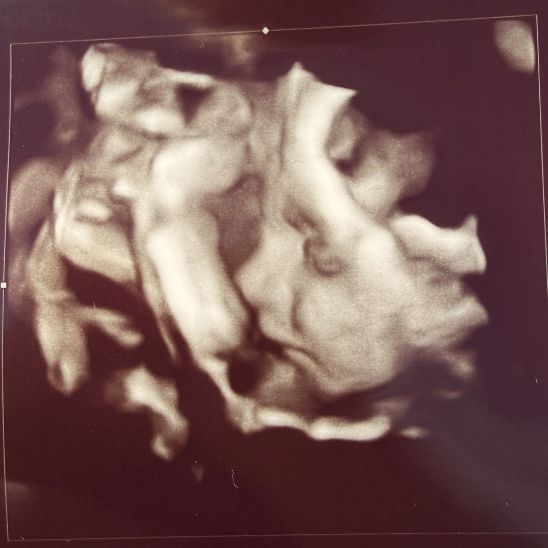 Photo shared by Madison for their Babylist baby registry.