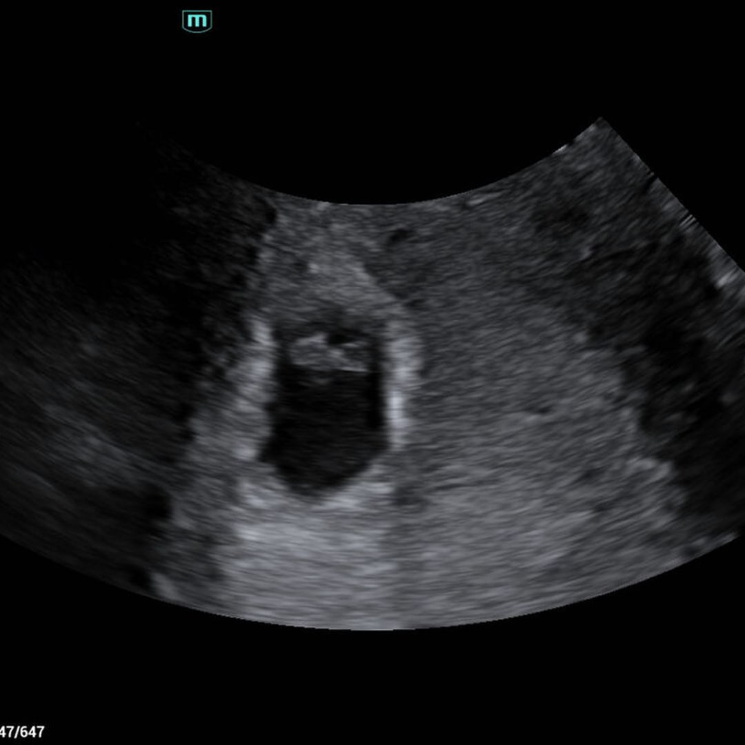 Photo shared by Tressia for their Babylist baby registry.