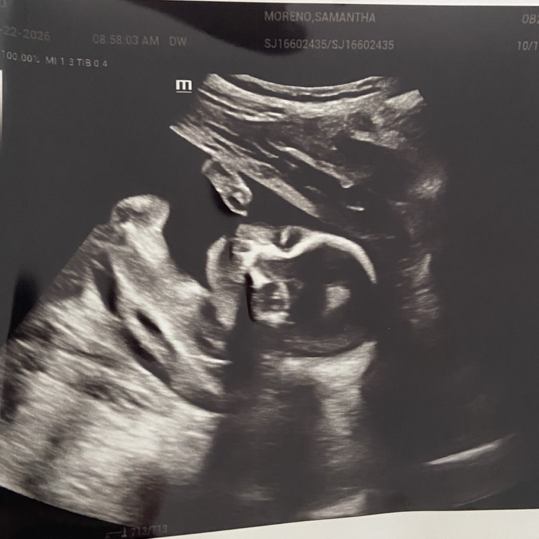 Photo shared by Samantha for their Babylist baby registry.