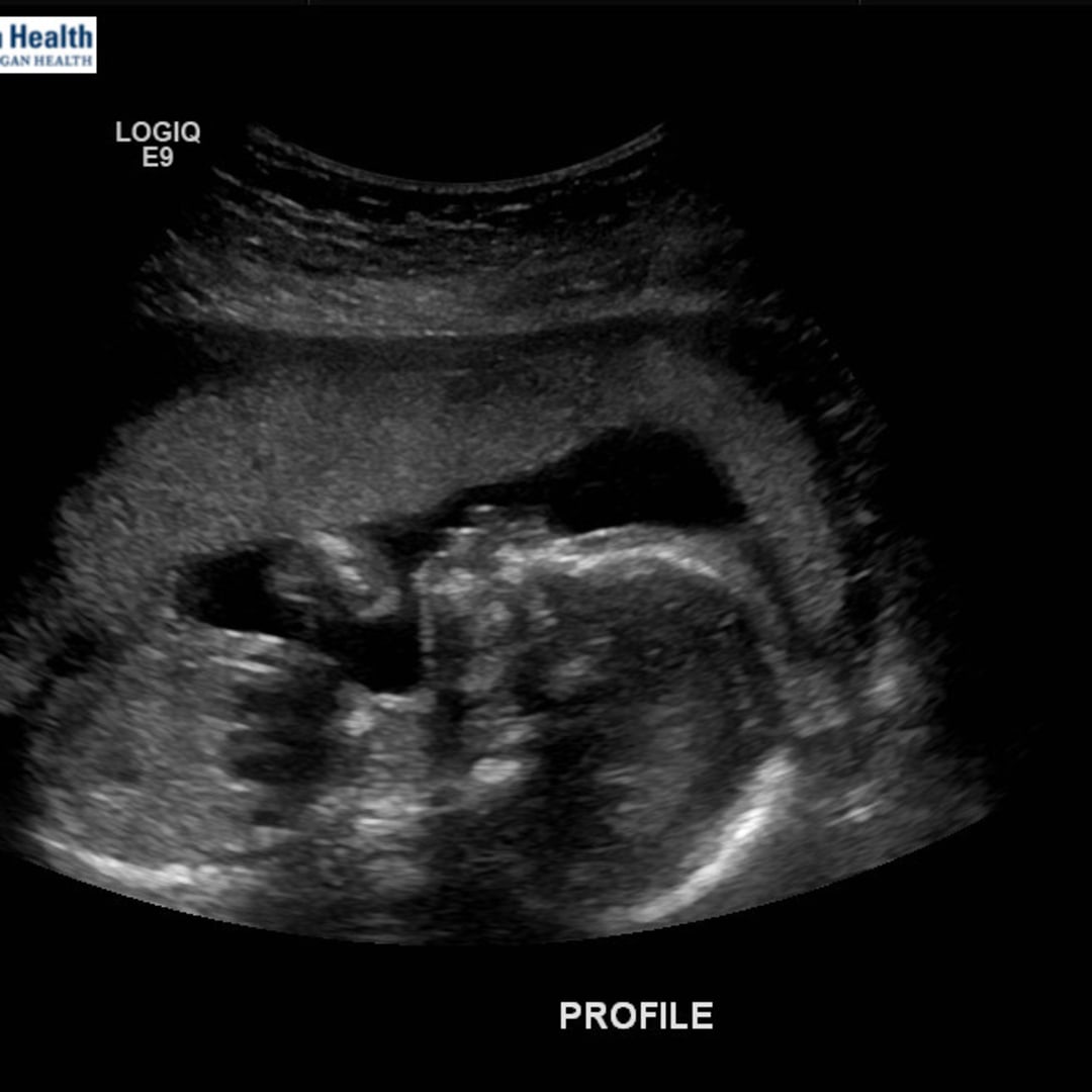 Photo shared by Erin for their Babylist baby registry.